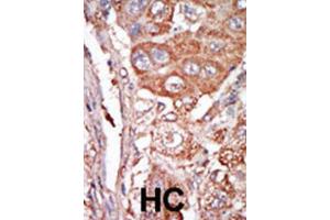 Immunohistochemistry (IHC) image for anti-Fibroblast Growth Factor 4 (FGF4) antibody (ABIN3003719) (FGF4 anticorps)