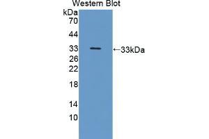 Western blot analysis of the recombinant protein. (NRP2 anticorps  (AA 231-490))