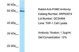 Western Blotting (WB) image for anti-Phosphoglucomutase 2 (PGM2) (C-Term) antibody (ABIN2774378) (Phosphoglucomutase 2 anticorps  (C-Term))
