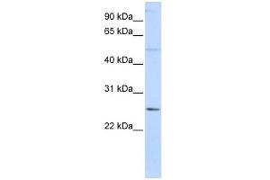 FTHL17 antibody used at 1 ug/ml to detect target protein.