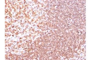 Formalin-fixed, paraffin-embedded human Tonsil stained with CD74 Ab (SPM523). (CD74 anticorps)
