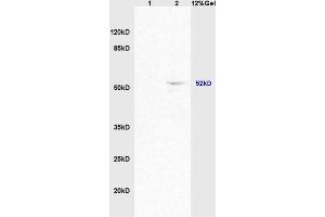 Lane 1: mouse brain lysates Lane 2: mouse heart lysates probed with Anti ACTRIC/Activin A Receptor Type IC Polyclonal Antibody, Unconjugated (ABIN714596) at 1:200 in 4 °C.