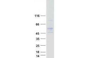 Validation with Western Blot