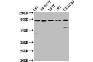 Western Blot Positive WB detected in: U87 whole cell lysate, SH-SY5Y whole cell lysate, 293T whole cell lysate, 293 whole cell lysate, Colo320 whole cell lysate All lanes: SLC26A4 antibody at 5. (SLC26A4 anticorps  (AA 592-655))