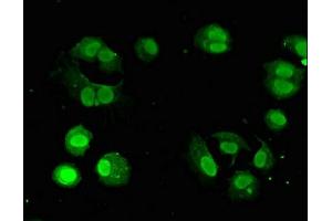 Immunofluorescent analysis of MCF-7 cells using ABIN7154703 at dilution of 1:100 and Alexa Fluor 488-congugated AffiniPure Goat Anti-Rabbit IgG(H+L)