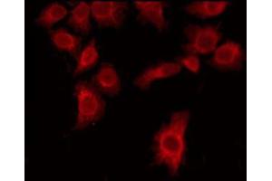 ABIN6275824 staining Hela by IF/ICC. (CYP20A1 anticorps  (Internal Region))