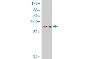 Western Blot detection against Immunogen (38.
