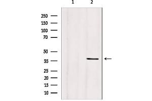 Western blot analysis of extracts from mouse brain, using CLTA antibody. (CLTA anticorps)