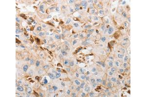 Immunohistochemistry (IHC) image for anti-Solute Carrier Family 15 (H+/Peptide Transporter), Member 2 (SLC15A2) antibody (ABIN2431771) (SLC15A2 anticorps)