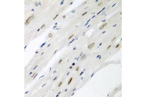 Immunohistochemistry of paraffin-embedded mouse heart using CDC27 antibody (ABIN3015756, ABIN3015757, ABIN1679113 and ABIN6219104) at dilution of 1:200 (40x lens). (CDC27 anticorps  (AA 551-830))