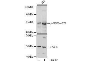 Western blot analysis of extracts of 293 cells, using Phospho-GSK3α-S21 antibody (ABIN6135231, ABIN6136096, ABIN6136097 and ABIN6225606) at 1:1000 dilution or GSK3α antibody (ABIN1680131, ABIN3015275, ABIN3015276 and ABIN6213918). (GSK3 alpha anticorps  (pSer21))