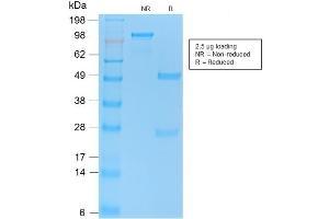 SDS-PAGE Analysis of Purified TP53 Rabbit Recombinant Monoclonal Antibody ABIN6383819. (Recombinant p53 anticorps  (AA 16-25))