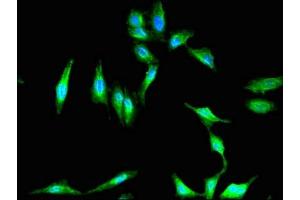 Immunofluorescent analysis of Hela cells using ABIN7152863 at dilution of 1:100 and Alexa Fluor 488-congugated AffiniPure Goat Anti-Rabbit IgG(H+L)