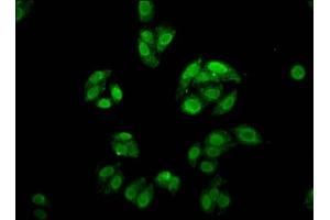 Immunofluorescence staining of HepG2 cells with ABIN7153038 at 1:166, counter-stained with DAPI. (FOXE3 anticorps  (AA 4-74))