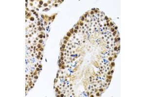 Immunohistochemistry of paraffin-embedded rat testis using CIRBP antibody. (CIRBP anticorps)