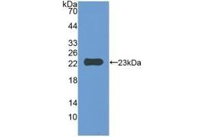 Detection of Recombinant IAP, Mouse using Polyclonal Antibody to Integrin Associated Protein (IAP) (CD47 anticorps  (AA 18-219))