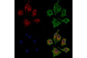 ABIN7094336 and ABIN7098383 staining HepG2 cells by IF/ICC. (Ceramide Synthase 2 anticorps  (C-Term))