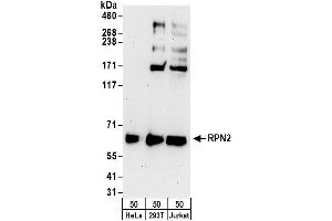 Western Blotting (WB) image for anti-Ribophorin II (RPN2) (AA 350-400) antibody (ABIN7455016)