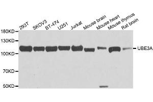 Western blot analysis of extracts of various cell lines, using UBE3A antibody.