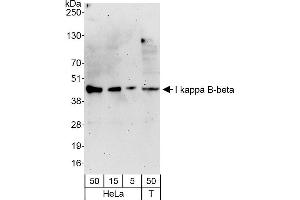 Western Blotting (WB) image for anti-NF-kappa-B inhibitor beta (NFKBIB) (AA 306-356) antibody (ABIN7451814)
