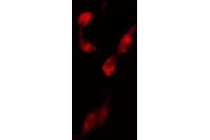 ABIN6274210 staining 293 cells by IF/ICC.