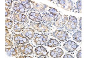 anti-UHRF1 (ICBP90) Binding Protein 1-Like (UHRF1BP1L) (C-Term) antibody