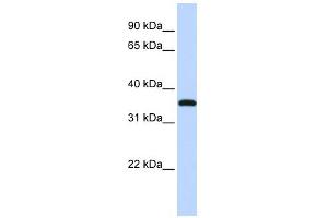 VGLL3 antibody used at 1 ug/ml to detect target protein. (VGLL3 anticorps)