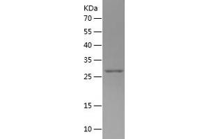 Galectin 3 (LGALS3) (AA 4-262) protein (His tag)