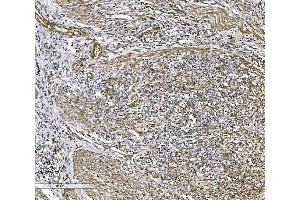 IHC analysis of COL4A3 using anti-COL4A3 antibody (ABIN7600055).