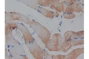 Detection of REG3b in Mouse Skeletal muscle Tissue using Polyclonal Antibody to Regenerating Islet Derived Protein 3 Beta (REG3b)