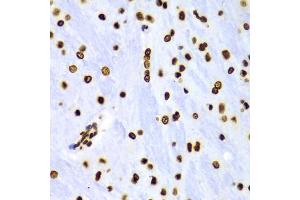 Immunohistochemistry of paraffin-embedded Rat brain using Dimethyl-Histone H3-K4 antibody (ABIN5969803) at dilution of 1/100 (40x lens). (Histone 3 anticorps  (H3K4me2))
