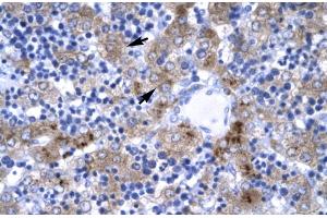 anti-Interferon Regulatory Factor 9 (IRF9) (N-Term) antibody