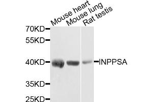 Western blot analysis of extracts of various cell lines, using INPP5A antibody (ABIN5971690) at 1/1000 dilution. (INPP5A anticorps)