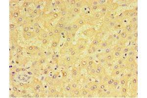 Immunohistochemistry of paraffin-embedded human liver tissue using ABIN7143385 at dilution of 1:100 (F4/80 anticorps  (AA 21-290))