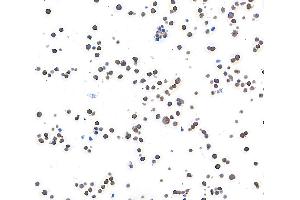 Immunocytochemistry (ICC) image for anti-Metastasis Associated in Colon Cancer 1 (MACC1) (AA 100-150) antibody (ABIN7453975)