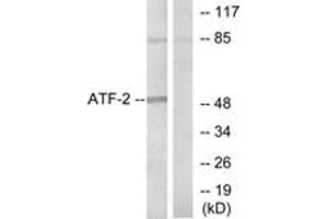 Western Blotting (WB) image for anti-Activating Transcription Factor 2 (ATF2) (AA 38-87) antibody (ABIN2888951) (ATF2 anticorps  (AA 38-87))