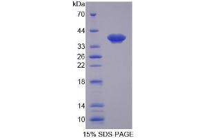 SDS-PAGE analysis of Human SLC25A39 Protein. (SLC25A39 Protéine)