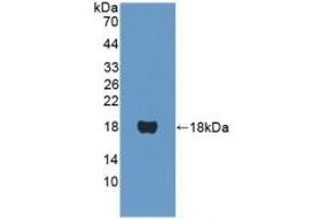Detection of Recombinant PPARa, Human using Polyclonal Antibody to Peroxisome Proliferator Activated Receptor Alpha (PPARa) (PPARA anticorps  (AA 61-170))