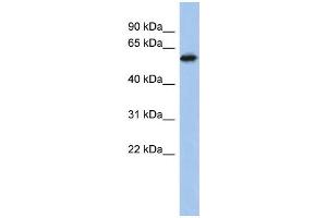WB Suggested Anti-ZNF496 Antibody Titration: 0. (ZNF496 anticorps  (Middle Region))