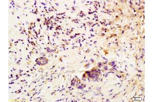 Immunohistochemistry (Paraffin-embedded Sections) (IHC (p)) image for anti-Colony Stimulating Factor 3 (Granulocyte) (CSF3) (AA 155-198) antibody (ABIN736521) (G-CSF anticorps  (AA 155-198))
