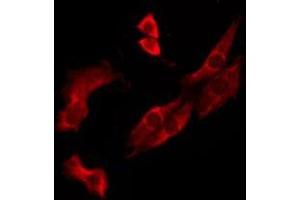 ABIN6276244 staining MCF7 by IF/ICC. (OR10J3 anticorps  (Internal Region))