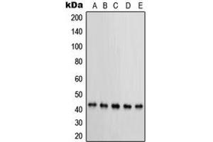 Western blot analysis of PRKAR1B expression in MCF7 (A), KNRK (B), NIH3T3 (C), HeLa (D), BT20 (E) whole cell lysates. (PRKAR1B anticorps  (Center))