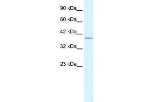 WB Suggested Anti-RIMS3 Antibody Titration:  1. (RIMS3 anticorps  (C-Term))
