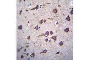 Immunohistochemistry analysis in formalin fixed and paraffin embedded human brain tissue reacted with Fukutin Antibody (Center) followed by peroxidase conjugation of the secondary antibody and DAB staining.