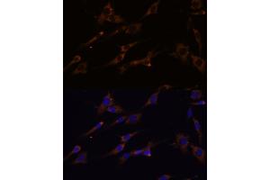 Immunofluorescence analysis of C6 cells using RPL7A Polyclonal Antibody (ABIN6128657, ABIN6147150, ABIN6147152 and ABIN6217809) at dilution of 1:100 (40x lens).