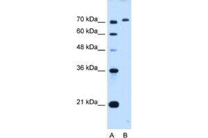 Western Blotting (WB) image for anti-GPI Anchor Attachment Protein 1 (GPAA1) antibody (ABIN2462976) (GPAA1 anticorps)