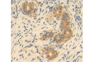 IHC-P analysis of Kidney tissue, with DAB staining. (GDF9 anticorps  (AA 306-440))