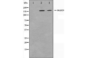 Western blot analysis on A549 and HuvEc cell lysate using MED24 Antibody,The lane on the left is treated with the antigen-specific peptide. (MED24 anticorps  (C-Term))