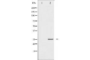 Western blot analysis of p21 Cip1 expression in EGF treated HeLa whole cell lysates,The lane on the left is treated with the antigen-specific peptide. (p21 anticorps  (C-Term))