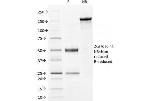 SDS-PAGE Analysis Purified Filaggrin Mouse Monoclonal Antibody (FLG/1561). (Filaggrin anticorps  (AA 198-288))